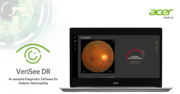 Acer Medical Inc. ร่วมกับ 4 โรงพยาบาล ทดลองใช้งาน Verisee DR ซอฟต์แวร์ วินิจฉัยภาวะเสี่ยงของโรคเบาหวานขึ้นจอประสาทตา เพิ่มช่องทางการเข้าถึงบริการทางการแพทย์ได้อย่างรวดเร็ว [Guest Post]